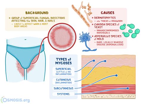 Infographic illustrating symptoms of candidiasis, including red or discolored rashes, scaling, and itching.