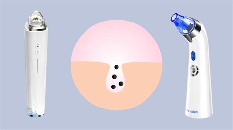 Close-up of various suction heads for pore vacuums, highlighting different sizes and shapes.