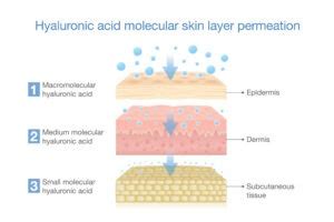 Diagram illustrating how hyaluronic acid molecules bind to water and hydrate the skin.