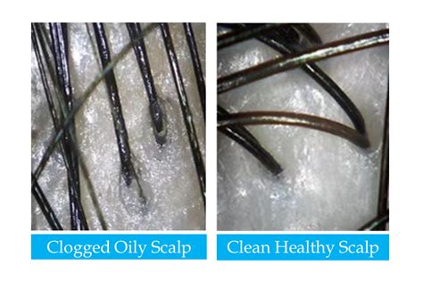 Before and after photos illustrating the positive impact of scalp treatments on hair health and appearance.