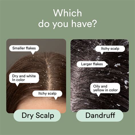 Infographic comparing symptoms of dry scalp and dandruff.