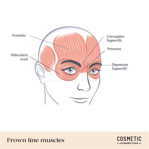 Diagram illustrating the anatomy of the forehead and brow area, highlighting key muscles and skin structures affected by aging and brow lift surgery.