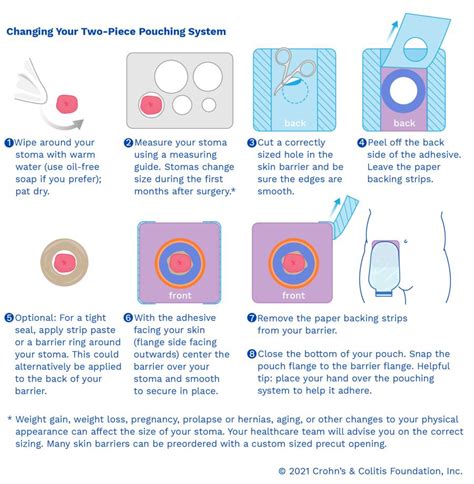 Diagram illustrating the different parts of a stoma appliance and common areas of leakage onto peristomal skin.