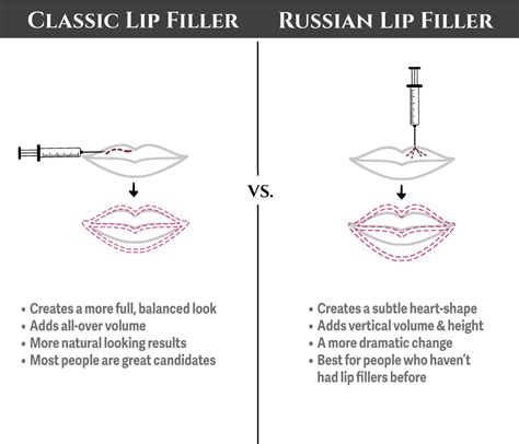 Diagram comparing different lip filler injection techniques and their resulting shapes.