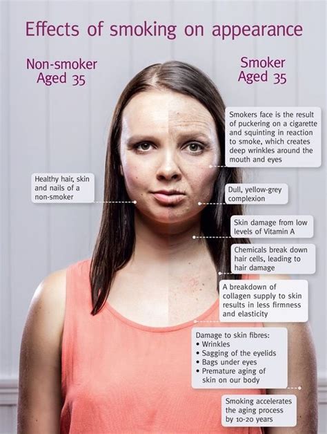 Infographic illustrating the causes of lip lines: sun damage, smoking, aging, repetitive facial expressions.