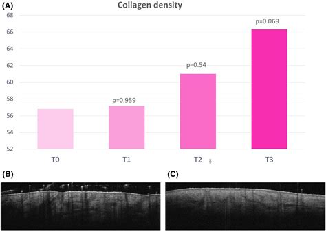 Examples of collagen density measurements in different anatomical areas of the skin.