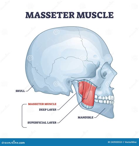 Diagram illustrating the location of the masseter muscle in the jaw.