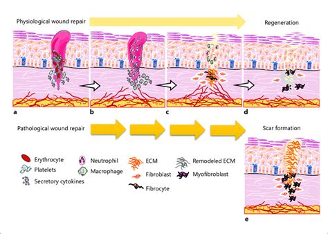 Infographic illustrating the process of skin regeneration stimulated by growth factors from platelets.