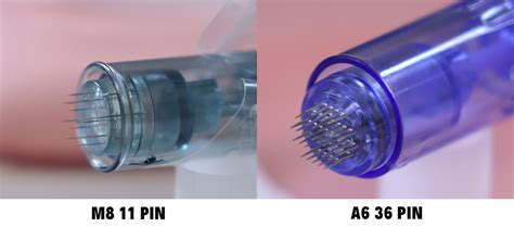 A close-up image of a microneedling pen device, highlighting its fine needles.