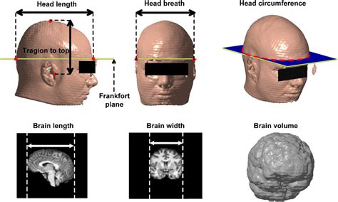 Diagram illustrating the four sections of the head for product application and the recommended distance from the scalp.