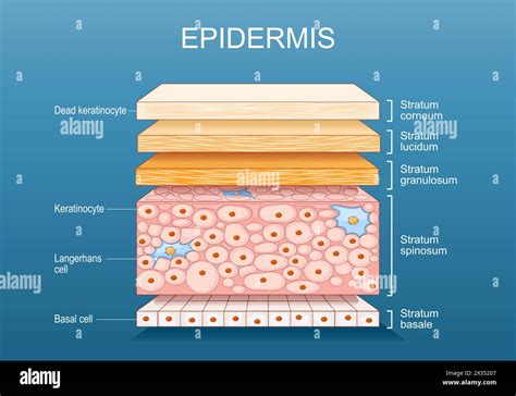 Illustration of a dog's skin cross-section showing Staphylococcus bacteria multiplying in a damaged epidermal layer