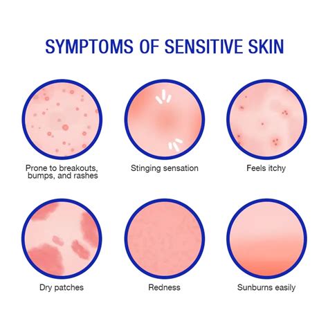 Illustration showing a baby's sensitive skin with common irritations like redness and dryness.