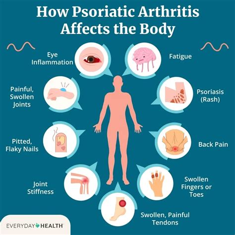 Infographic illustrating the dual impact of psoriatic arthritis on skin and joints.