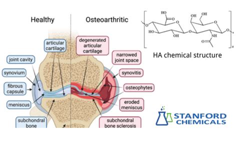 Diagram illustrating the role of hyaluronic acid in joint lubrication.