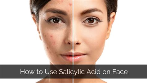 Split image showing a 'before' (slightly irritated) and 'after' (calmer) skin appearance after initial use of salicylic acid.