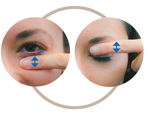 Illustration demonstrating eyelid massage techniques and proper application of eyelid tape.