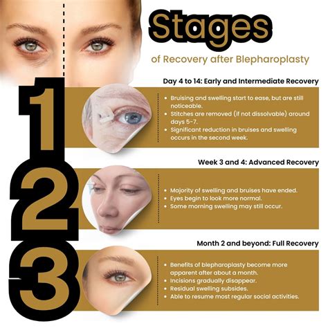 Timeline graphic showing the typical stages of healing after blepharoplasty, highlighting when lagophthalmos symptoms might resolve.