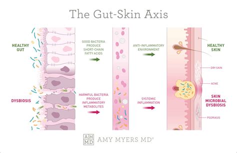 An illustration showing the gut-skin axis, with arrows indicating communication between the intestines and the skin.