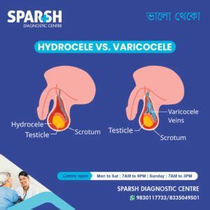 Infographic comparing varicocele and hydrocele.