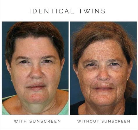 Side-by-side comparison photos showing skin aging with and without consistent sunscreen use.
