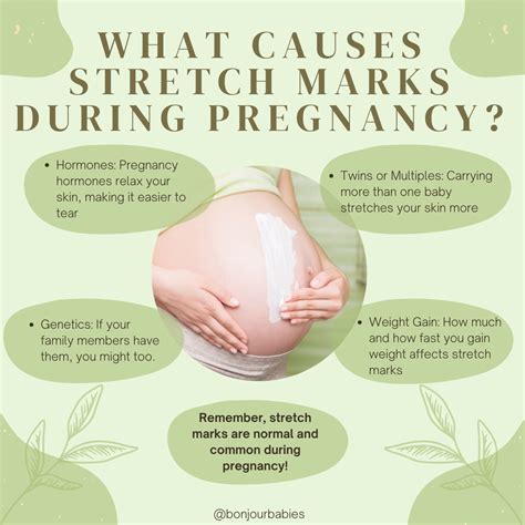 Infographic illustrating various causes of stretch marks like pregnancy, weight gain, and puberty