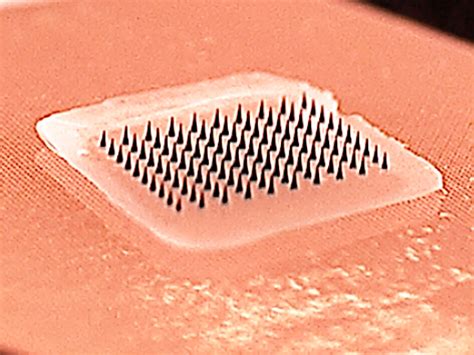 Close-up image of a microneedle patch