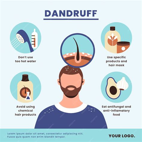 Infographic illustrating different types of dandruff and their visual characteristics.