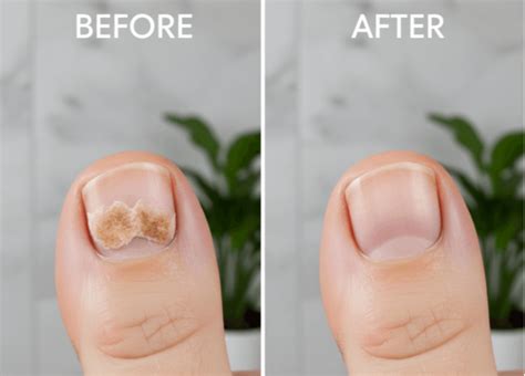 Collage of customer photos showing before-and-after results of using WellaNail.