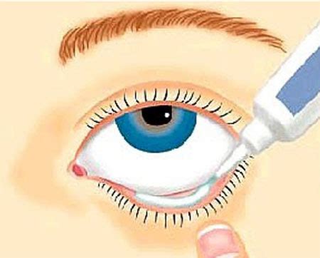 Illustration of a cat's eye with a dropper applying ointment