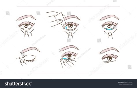 Diagram illustrating the steps for applying eye ointment to a cat