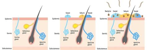 Diagram showing the relationship between hormones, sebum, and hair follicles