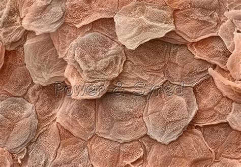 Microscopic view of skin cells, highlighting the removal of dead cells by glycolic acid