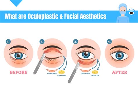 Diagram illustrating the anatomy of the eye and surrounding structures relevant to oculoplastic surgery