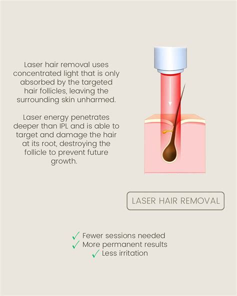 Diagram illustrating how laser energy penetrates the skin to stimulate collagen