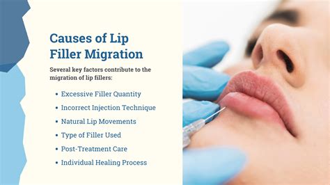 infographic detailing common causes of lip filler migration, such as poor injection technique, overfilling, and inadequate aftercare