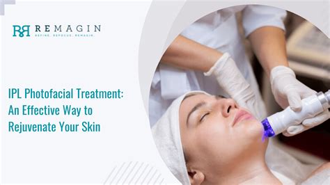 Woman undergoing an IPL photofacial treatment, with a technician holding the device to her face.