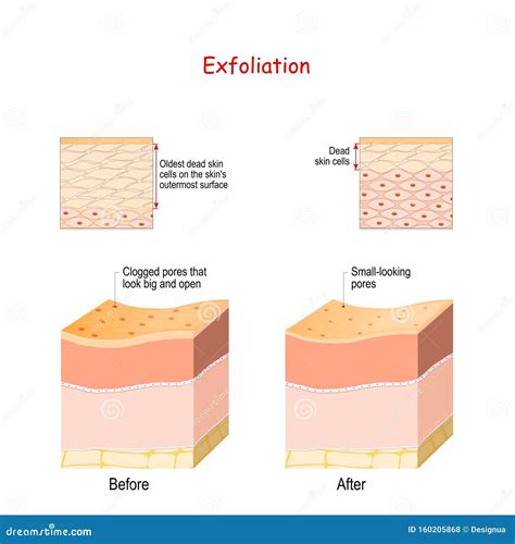 Close-up illustration of skin layers showing exfoliation process.