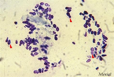 Microscopic image of Malassezia yeast in cat ear cytology