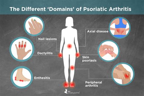 Image showcasing the characteristic skin plaques of psoriasis and an illustration of inflamed joints in psoriatic arthritis.