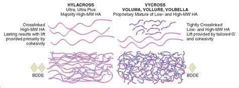 Infographic comparing different Juvederm Vycross fillers and their target areas.