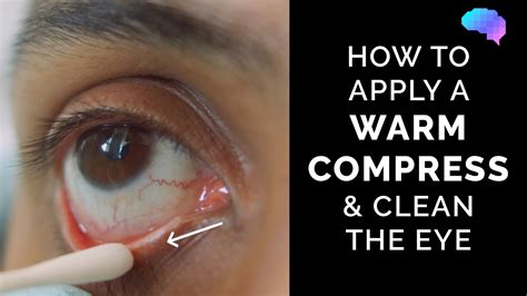 Illustration demonstrating the correct application of a cold compress to the eye area after surgery, emphasizing gentle pressure and a protective cloth barrier.