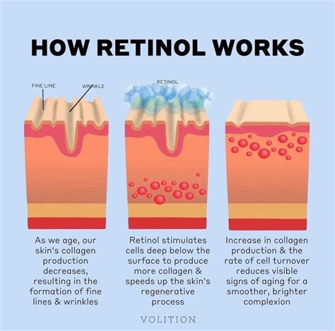 Infographic illustrating the different benefits of retinol: anti-aging, acne reduction, brightening, pore minimization, and fading dark spots.