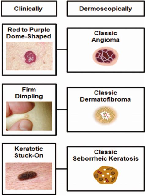 Collage of images showing different types of benign and malignant skin growths on dogs.