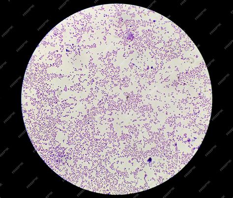 Microscopic image of Staphylococcus bacteria.