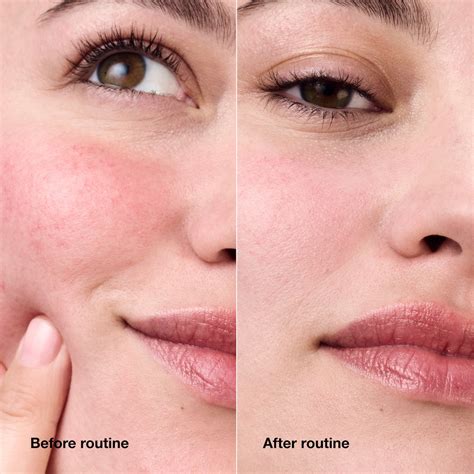 before and after photo demonstrating the color correcting effect of Clinique Redness Solutions Daily Protective Base