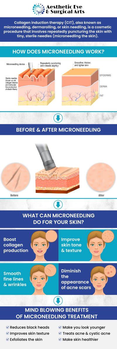 Illustration of various skin concerns that microneedling can address.