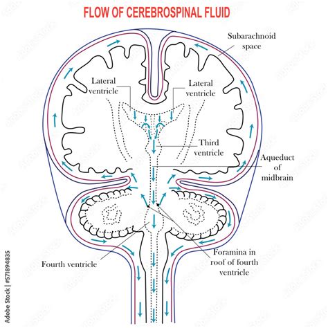 Diagram illustrating the normal and abnormal levels of IgG in cerebrospinal fluid.