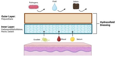 Diagram illustrating the layered structure of a hydrocolloid bandage and its function in wound healing.