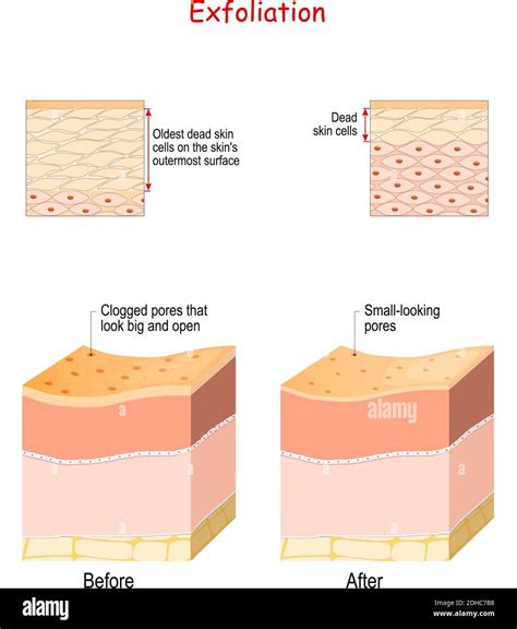 Diagram showing how AHAs work to remove dead skin cells and reveal new skin