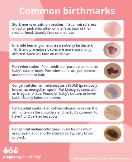 Infographic showing different types of common birthmarks in children